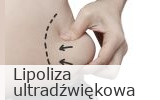 Lipoliza ultradźwiękowa Active Fit Pleszew ul. Traugutta 30