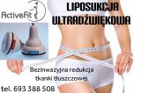 Fizjoterapia lipoliza ultradźwiękowa Pleszew Traugutta 30 Fizjo 1