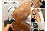 Fizjoterapia blizny 1 Terapia dr TECAR Active Fit Pleszew, Traugutta 30